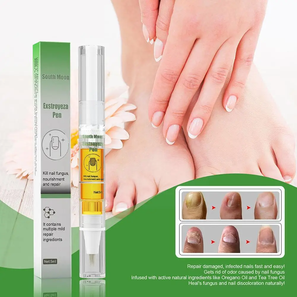

5ml Nail Fungal Treatment Pen Feet Care Nail Foot Toe Nail Fungus Removal Anti Nail Paronychia Gel Repair Fluid Onychomycos M0H9