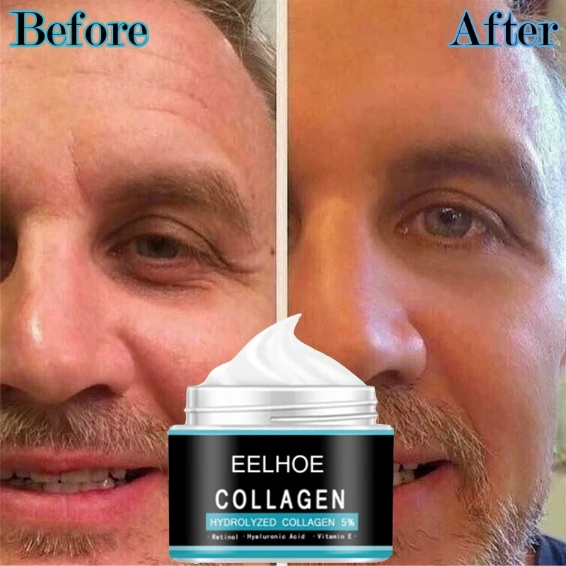 

EELHOE Collagen Creams For Men Anti Wrinkle Anti Aging Face Cream Firming Moisturizing Hyaluronic Acid Cream Facial Care