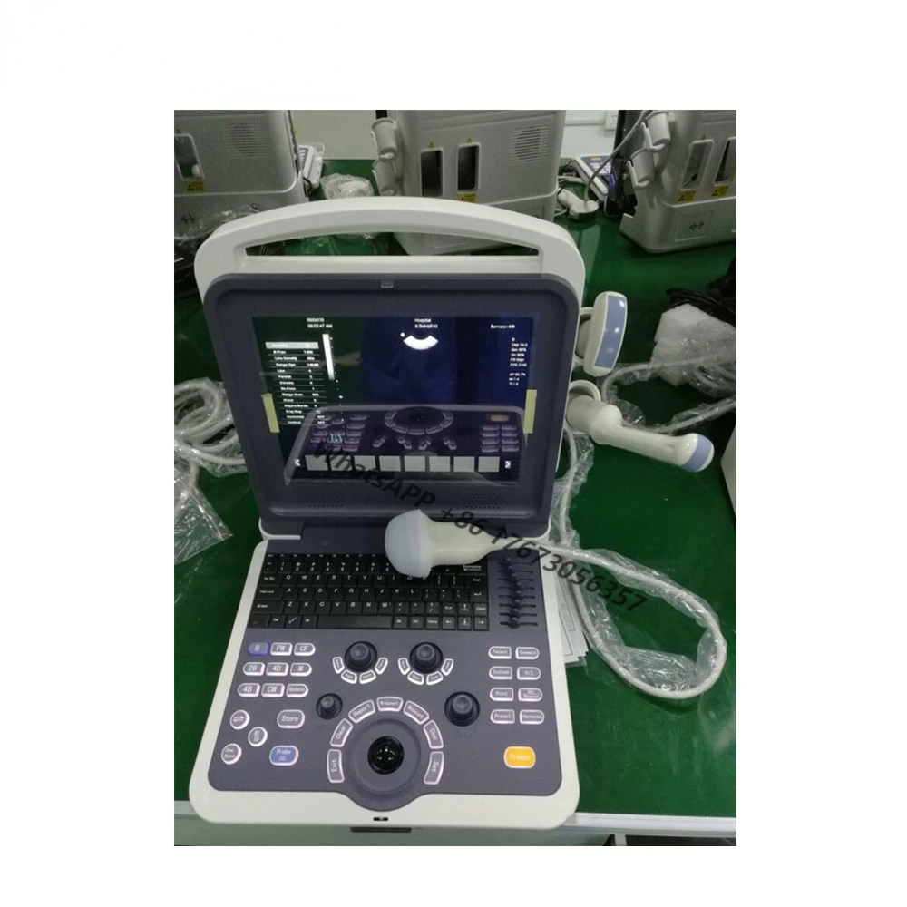 

Laptop Color Doppler ultrasound cheaper than M7