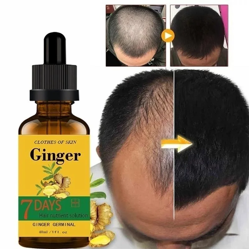 

Hair Growth Serum In 7 Days Fast Hair Growth Natural Stop Hair Loss Treatment Products Hair Treatment for Hair Growth Set