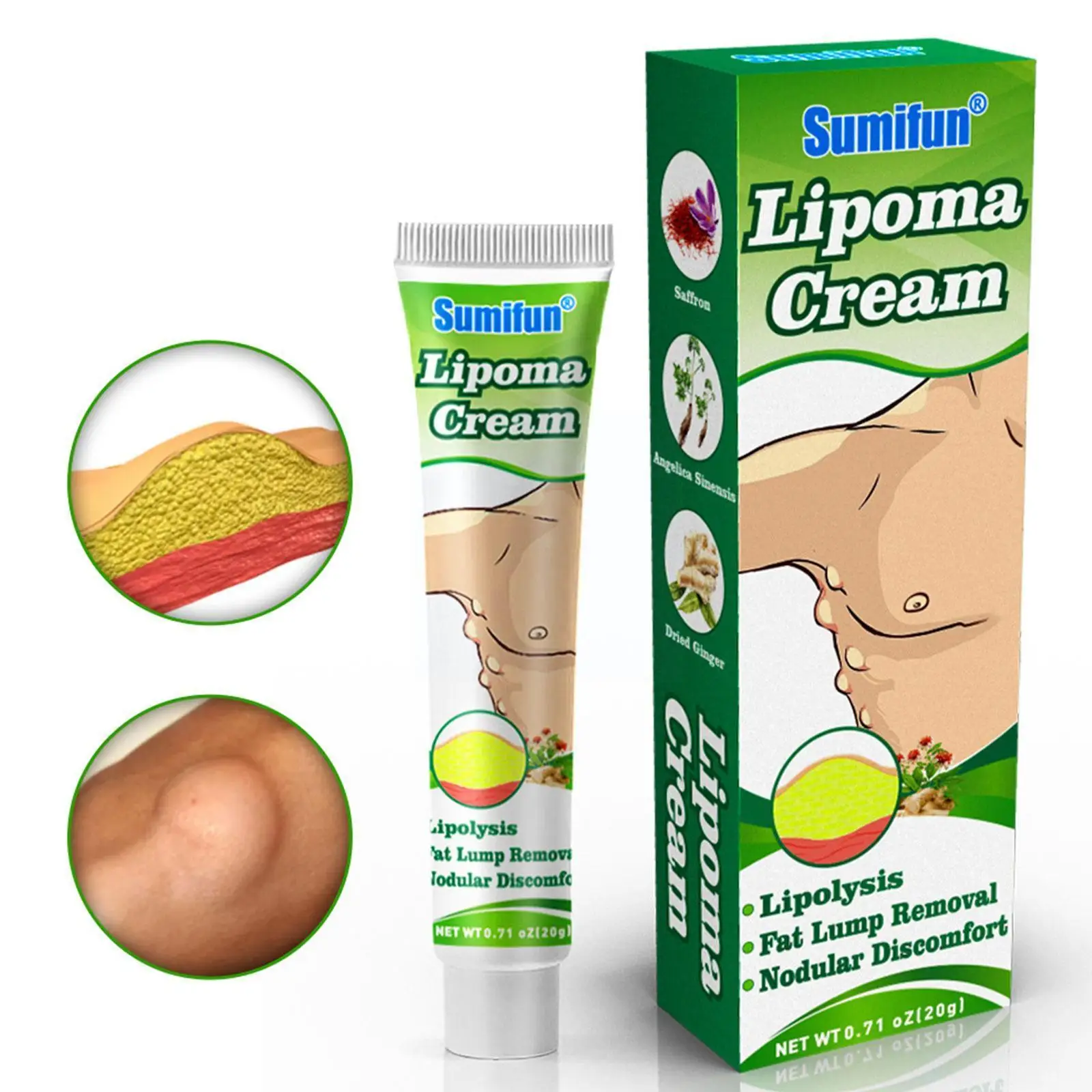 

20g Lipoma Care Cream Lipoma Removal Cream Treat Skin Cream Ointment Care Cellulite Care Fat Skin Swelling Granule Y8M8