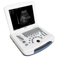cheapest clinic 2d diagnostic ultrasonic gel machine ultrasound portable for human