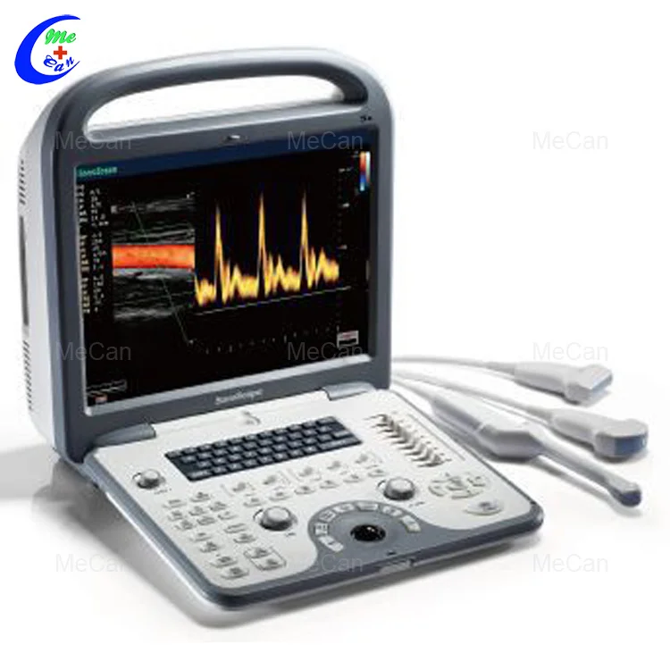 

Sonoscape S6 Cardiac 4D Color Doppler Echo Ultrasound Machine