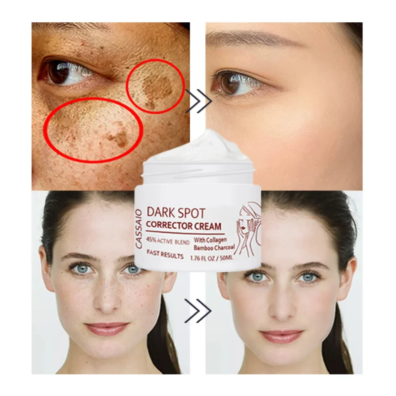 

Whitening Cream Remove Melasma Dark Spots Lighten Melanin Brightening Moisturizing Anti-aging Firming Vitamin C Cream