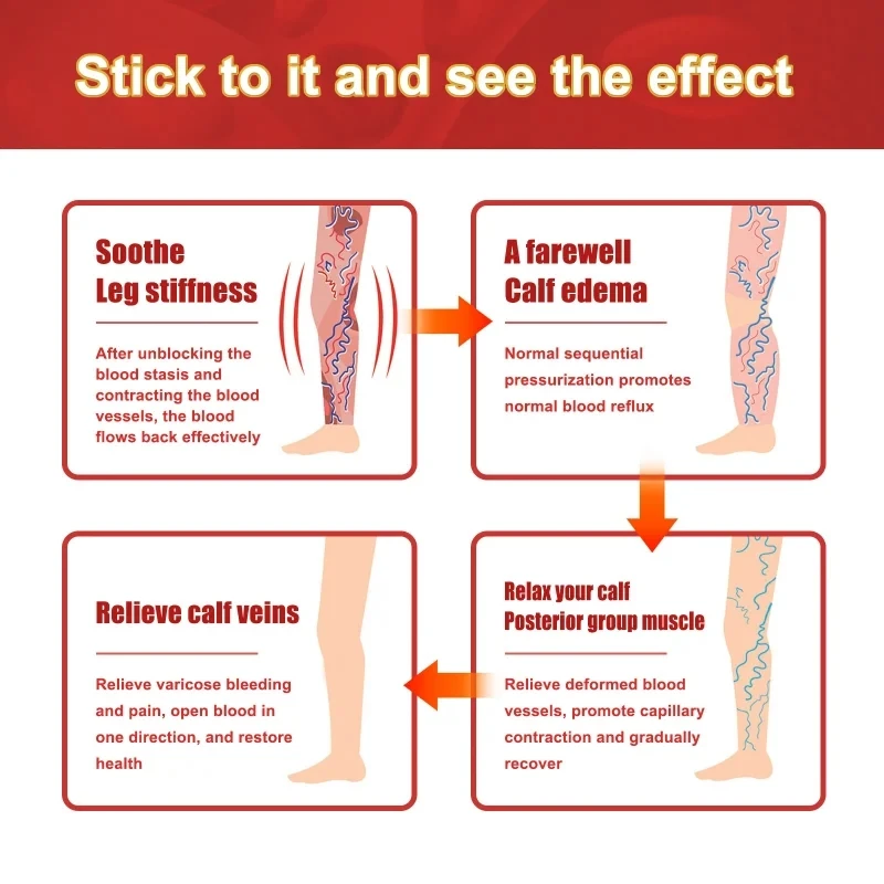 6/8/12 шт. лечение варикоцеле васкулита ног паука с венозным пластырем для снятия