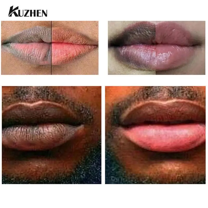 

Lip Lightening Scrub Balm Exfoliating Lightens Dark Lip Balm Eliminate Uneven Darkness on Lips Treatment Fast Results Lip Care