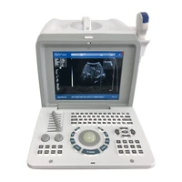 ultrasonography portable b bw mode ultrasound scan machine medical ultrasound instruments