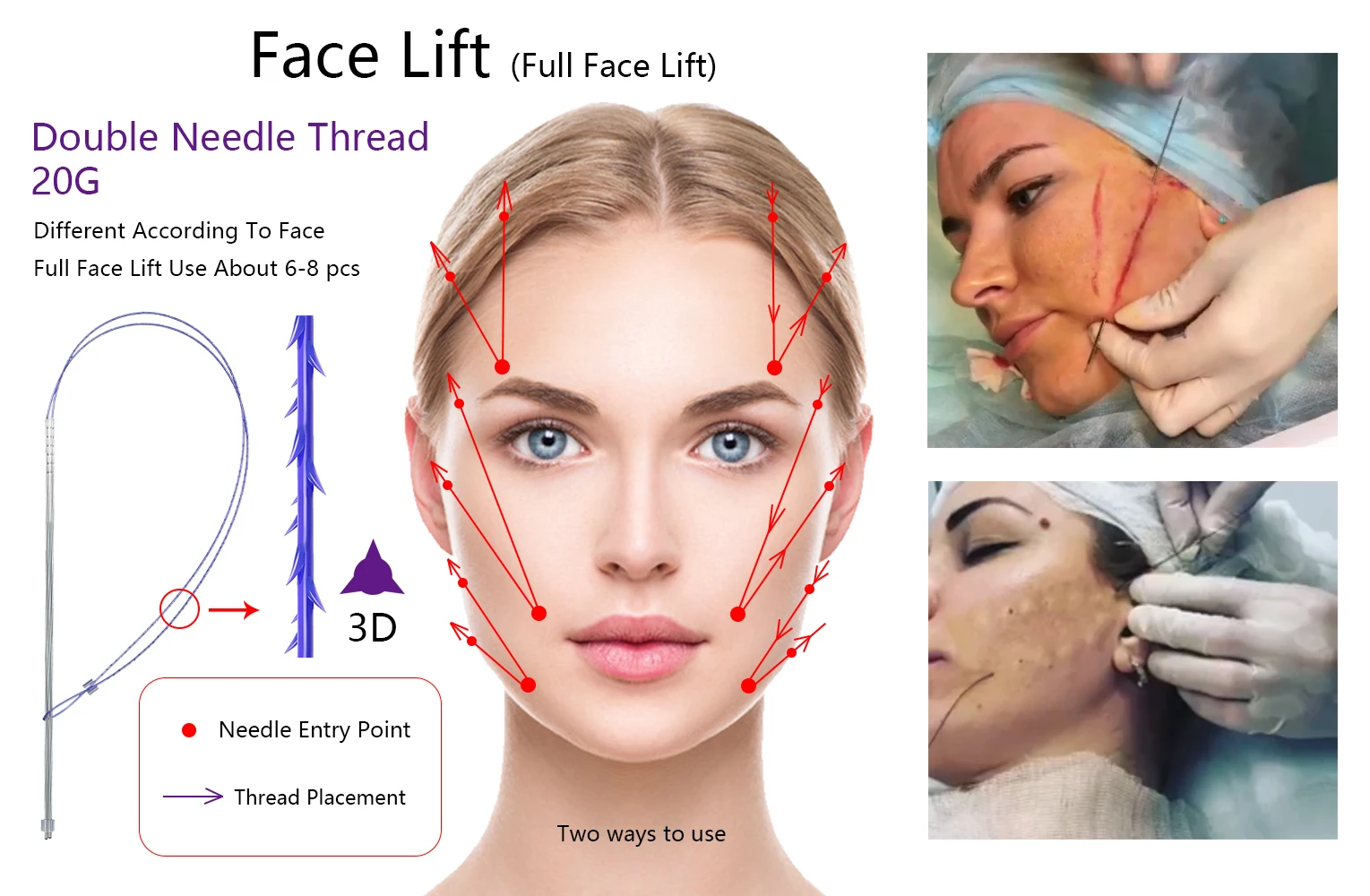 

1 шт. Cog Lif face v line Pdo Fox Eye Двойная резьба для рук подтяжка бровей 19 г 200 мм 20 г 300 м двойная игла
