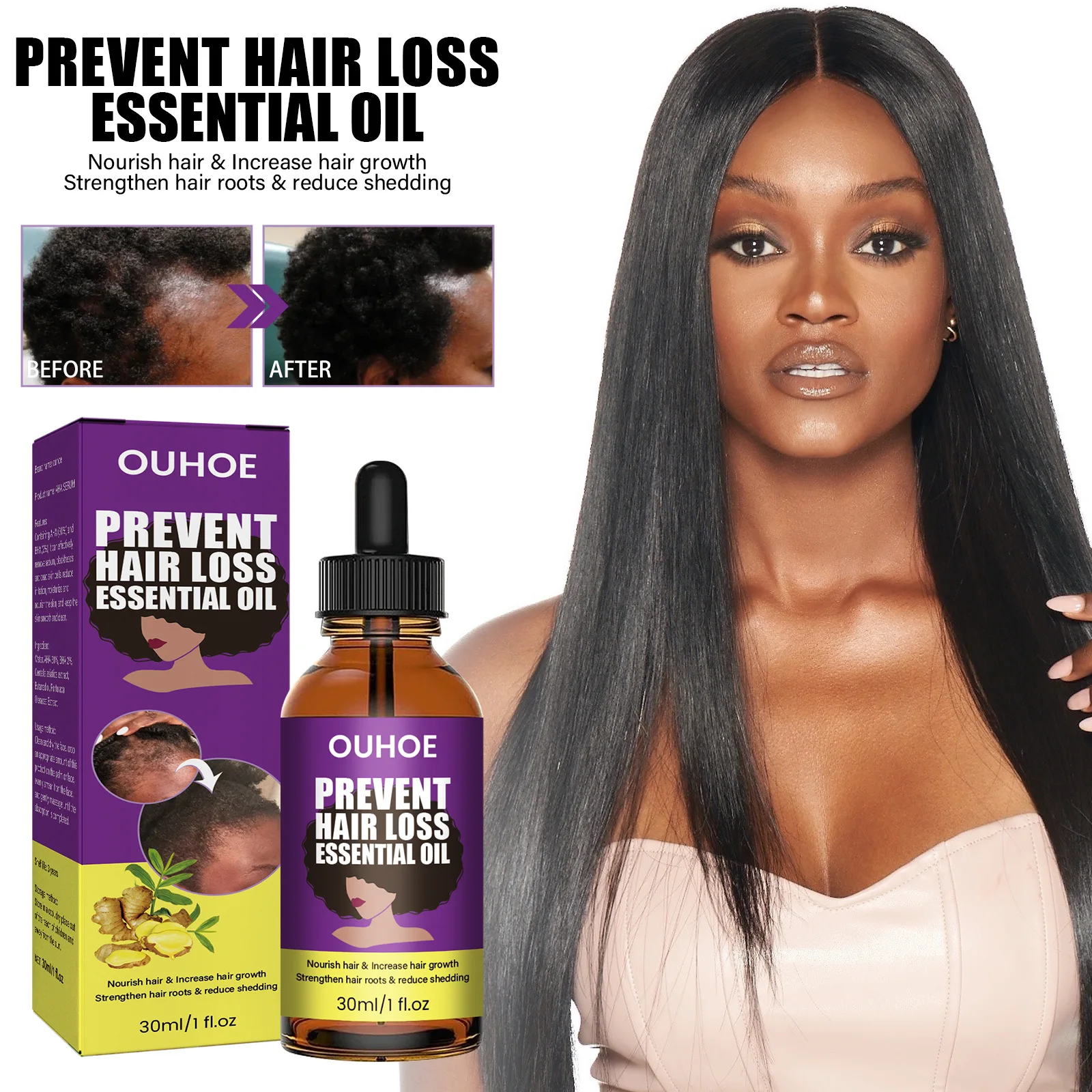 

30ml Anti Alopecia Oil Hair Growth Essential Oils for Black Women Essence Anti-Hair Loss Hair Serum for Thinning Hair Thickening