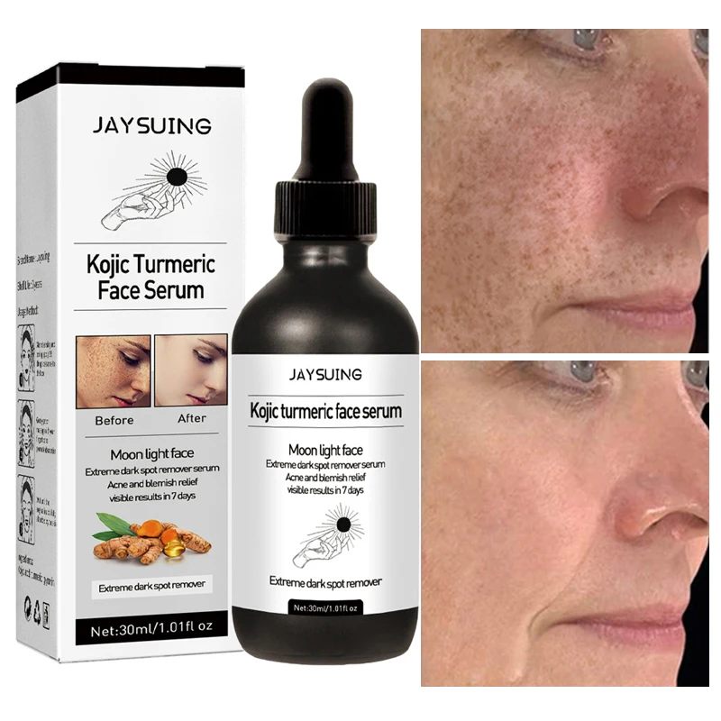 

Turmeric Freckle Whitening Serum 7 Days Fade Dark Spots Remove Melanin Pigmentation Anti Aging Moisturizing Brightening Care30ml