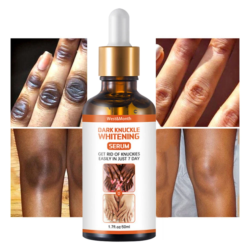

50ml Dark Kunckle Whitening Serum Improve Dullness Even Skin Tone Joints Elbows Knees Whitening Serum for Man and Woman 2022 New