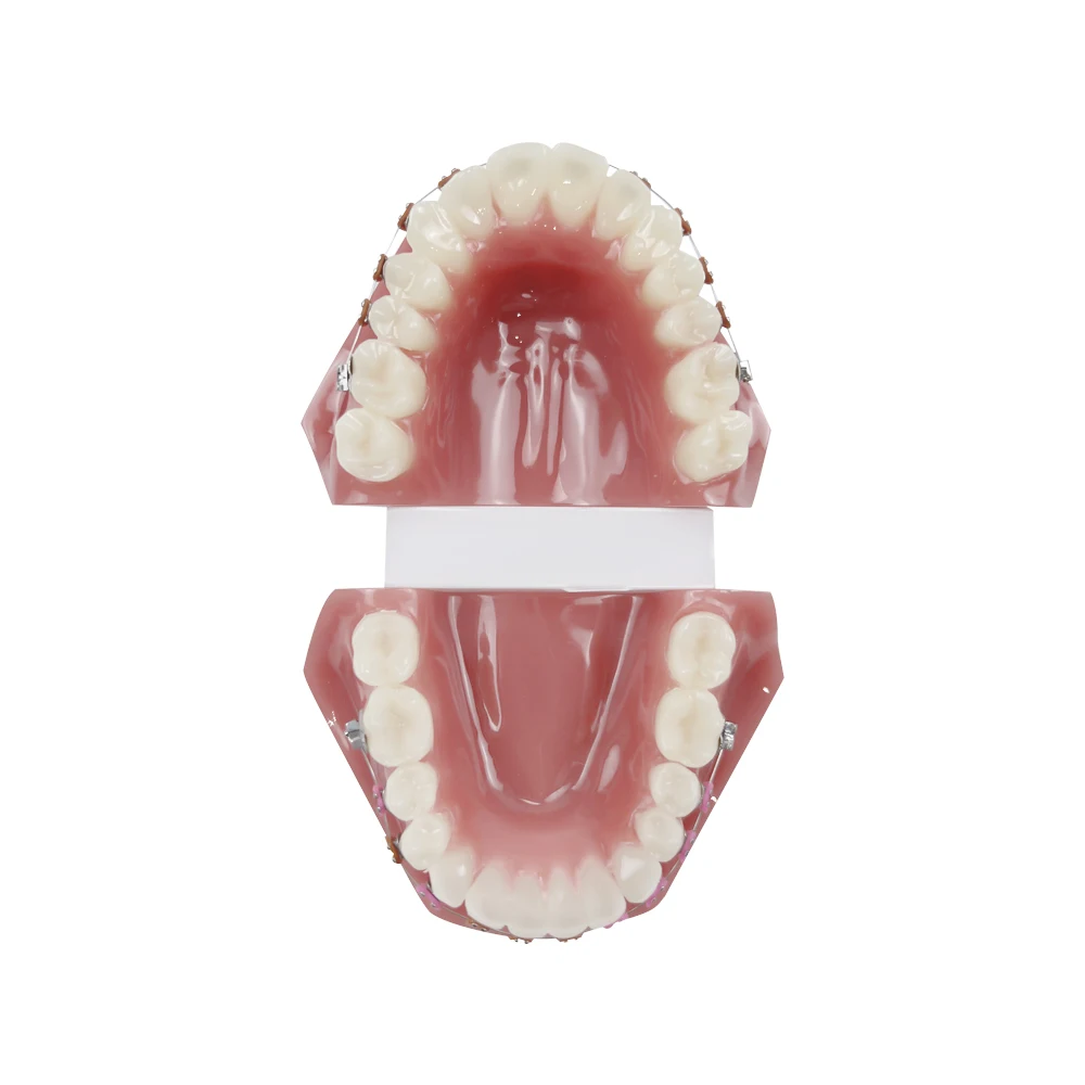 Ортодонтическая стоматологическая обучающая модель с полностью металлическим
