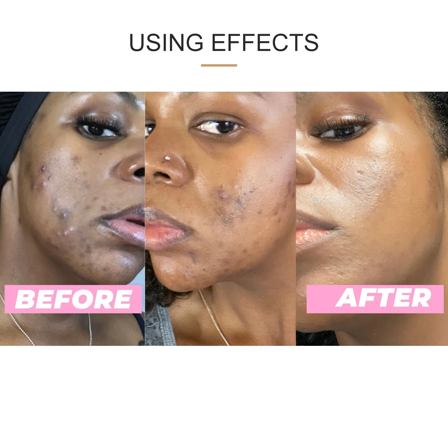 Маска для лица с витамином С куркума акне темные пятна удаление отшелушивающее