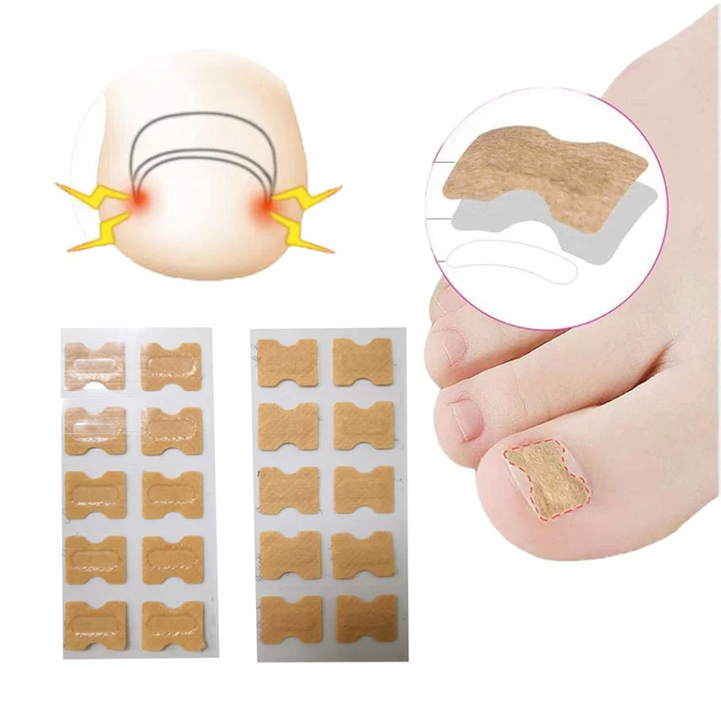 

20/50/100 шт., корректирующие наклейки для ногтей