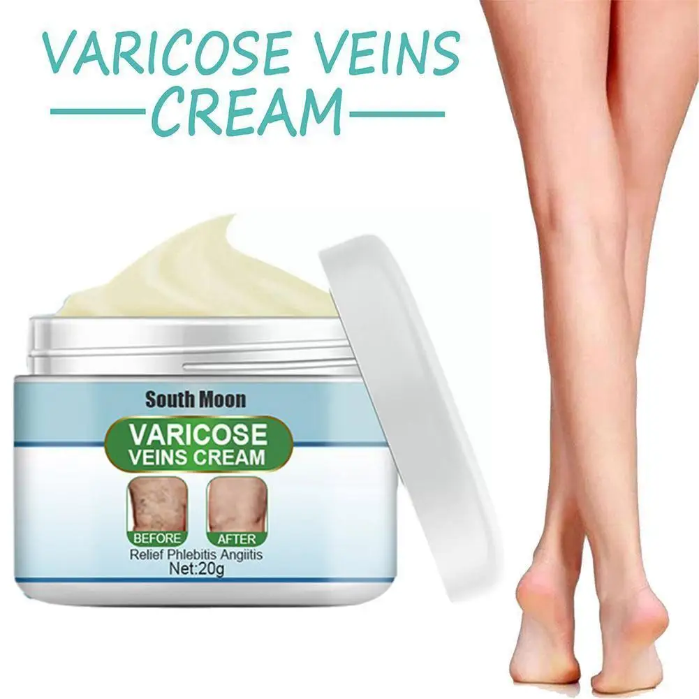 

Varicose Veins Cream Massage Ointmnet Vasculitis Phlebitis Plaster Relief Angiitis Medical Removal 20g Spider Pain Ointment L9f8