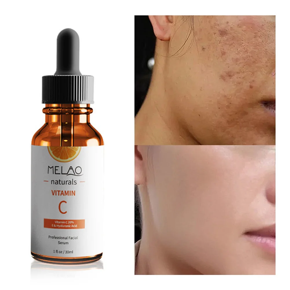 

30ml Vitamin C Liquid Face Serum Anti-Wrinkles Shrink Pores Face Firming Repairing Serum Skin Moisturizing Essence Skin Care