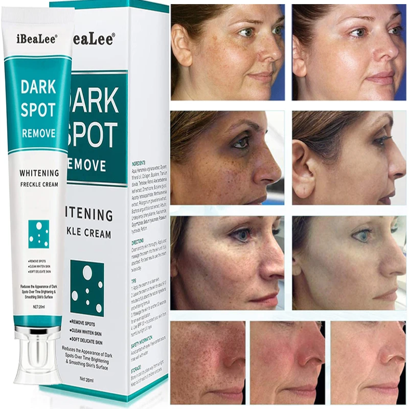 

IBeaLee крем для отбеливания веснушек удаляет мелазму, пятна акне, пигмент меланин, темные пятна, отбеливающий, увлажняющий крем для ухода за кожей