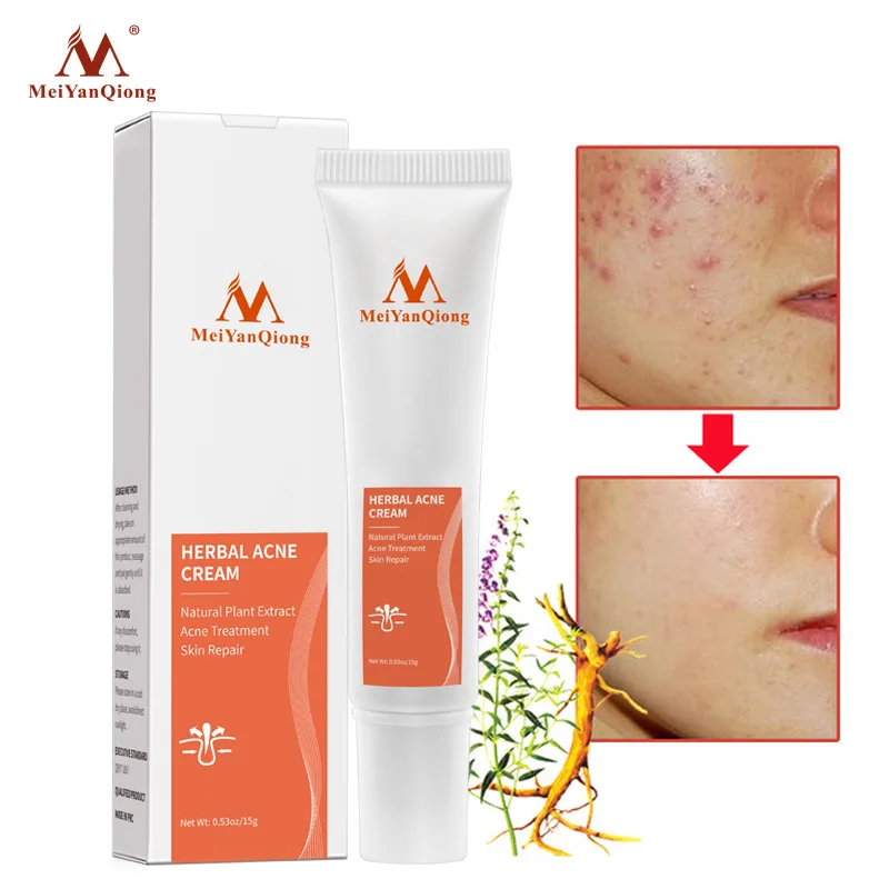 

Face Anti Acne Treatment Cream Scar Removal Oily Spots Skin Whitening Moisturizing Face Gel Skin Repairing Care Beauty Health