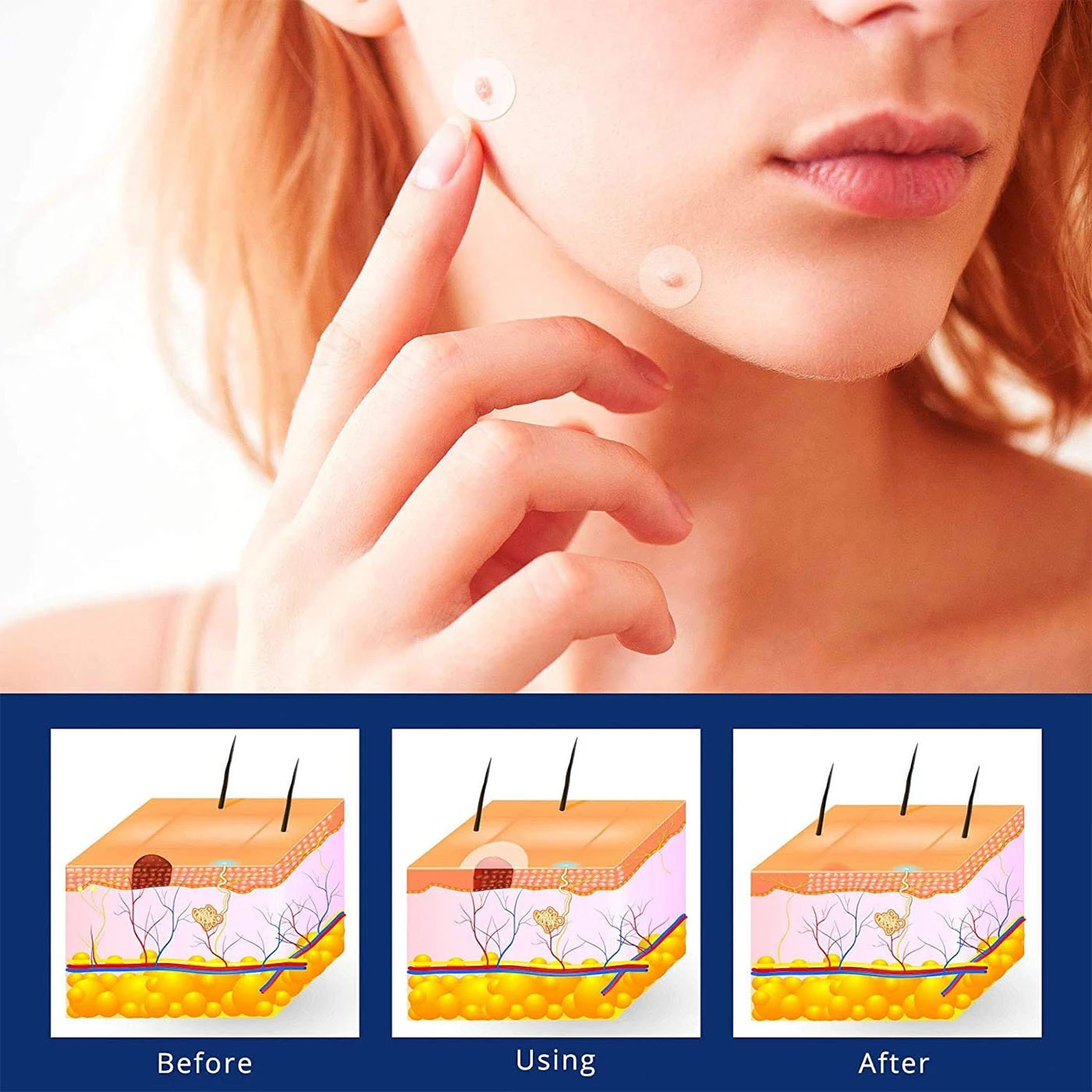 

Skin Tags Remover 144 PCS 144 Pcs Skin Tags Removal Patches With Herbal Ingredients Advanced Skin Tags Removal Patches For Face