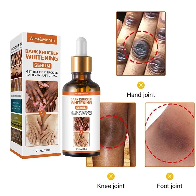 Средство для удаления темных суставов коленей Сыворотка от никотинамид