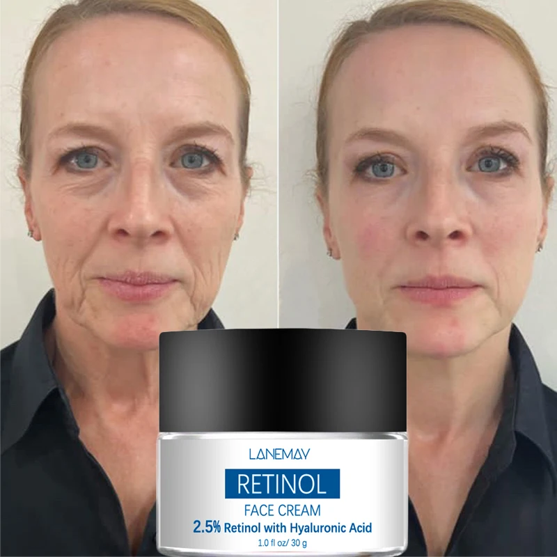 

Retinol Wrinkle Removing Cream Anti Aging Firming Lifting Fade Fine Lines Skin Brighten Moisturizing Skin Care Korean Cosmetics