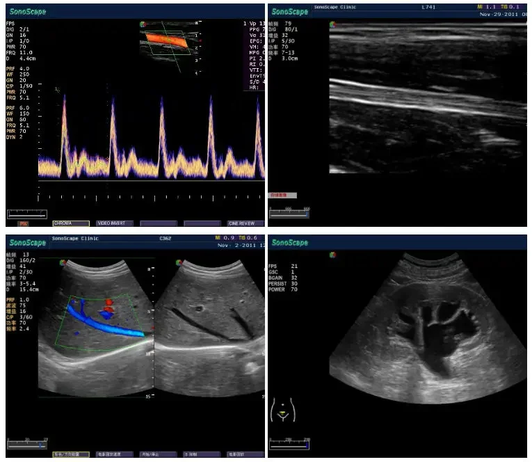 Рисунок 5 - Ультразвуковой сканер Sonoscape S11 Plus