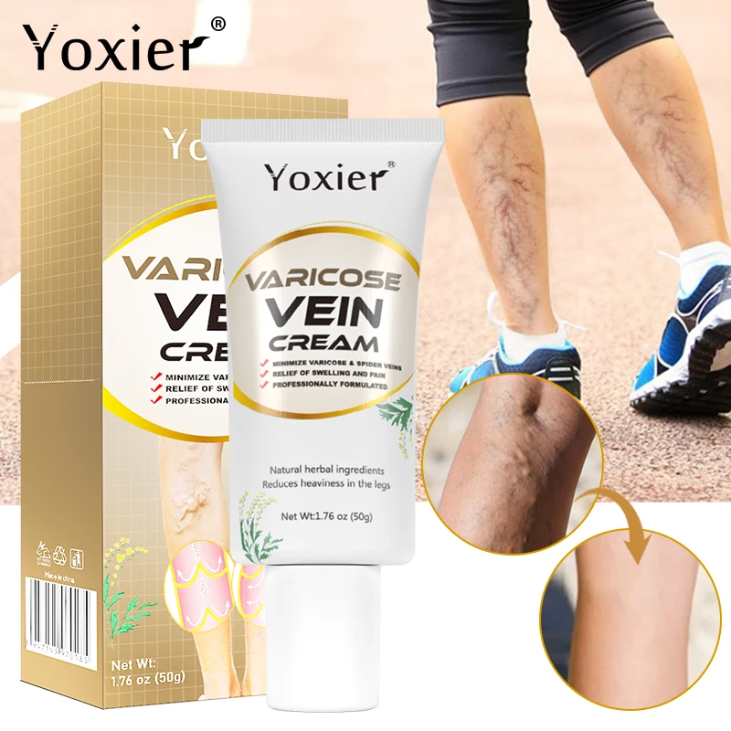 

Varicose Vein Cream Improve Spider Veins Spider Veins PhlebitisReduce Swelling Pain Promote Blood Circulation Body Care 50g