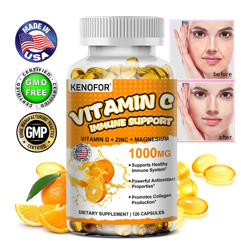 

KENOFOR Vitamin C Immune Support, Containing Vitamin D, Zinc, Magnesium, Powerful Antioxidant, Promotes Collagen Production