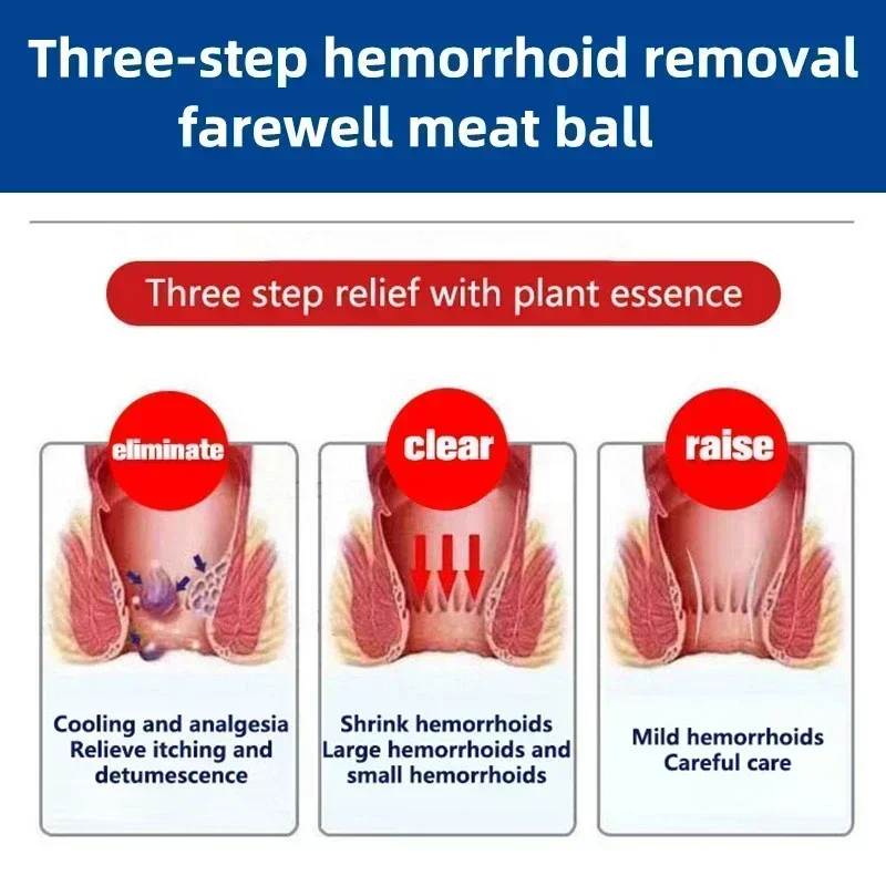 Крем для удаления геморроида NewHemorrhoid внутренний натуральный травяной экстракт