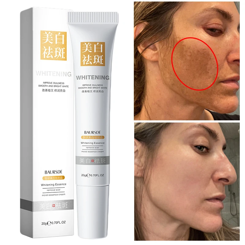 Powerful Whitening Freckles Cream Remove Dark Spots Fade Melanin Anti-Pigmentation Improve Dullness Fast Brighten Face Skin Care