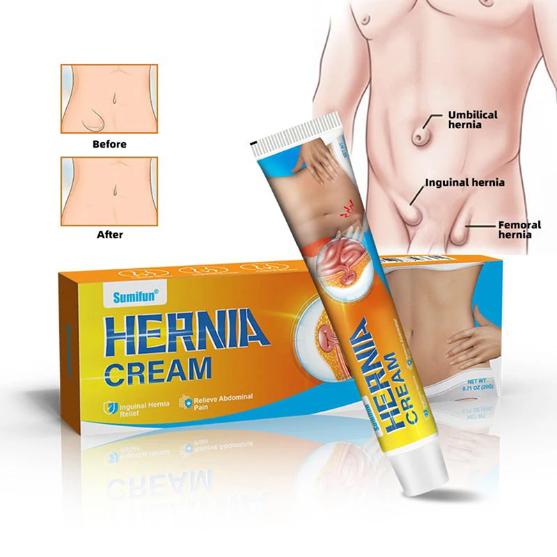 

1pc Hernia treatment cream Baby Medical Hernia Therapy Baby Body Care Umbilical Hernia Infantile Bag Physical Therapy Treatment