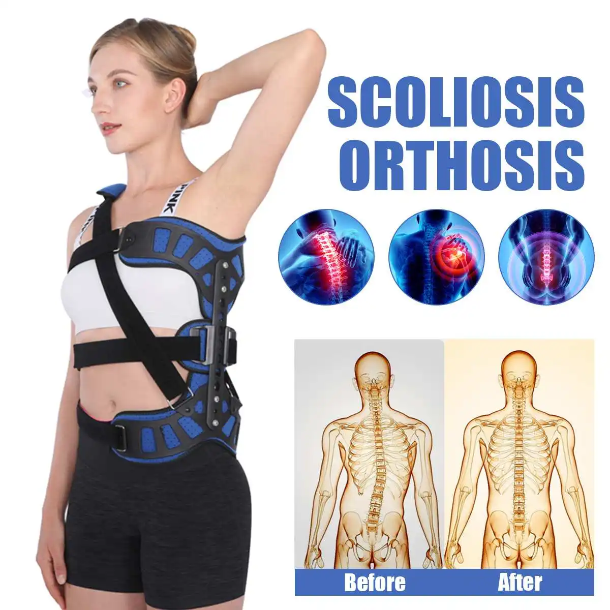 

New Adjustable Scoliosis Posture Corrector Spinal Auxiliary Orthosis for Back Postoperative Recovery for Adults Health Care