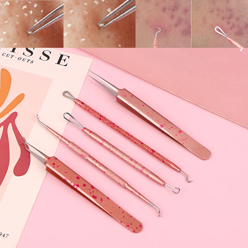 

Blackhead Removal Needles Black Dots Cleaner Stainless Steel Spot Extractor Acne Treatment Needle Face Clean Care Tools