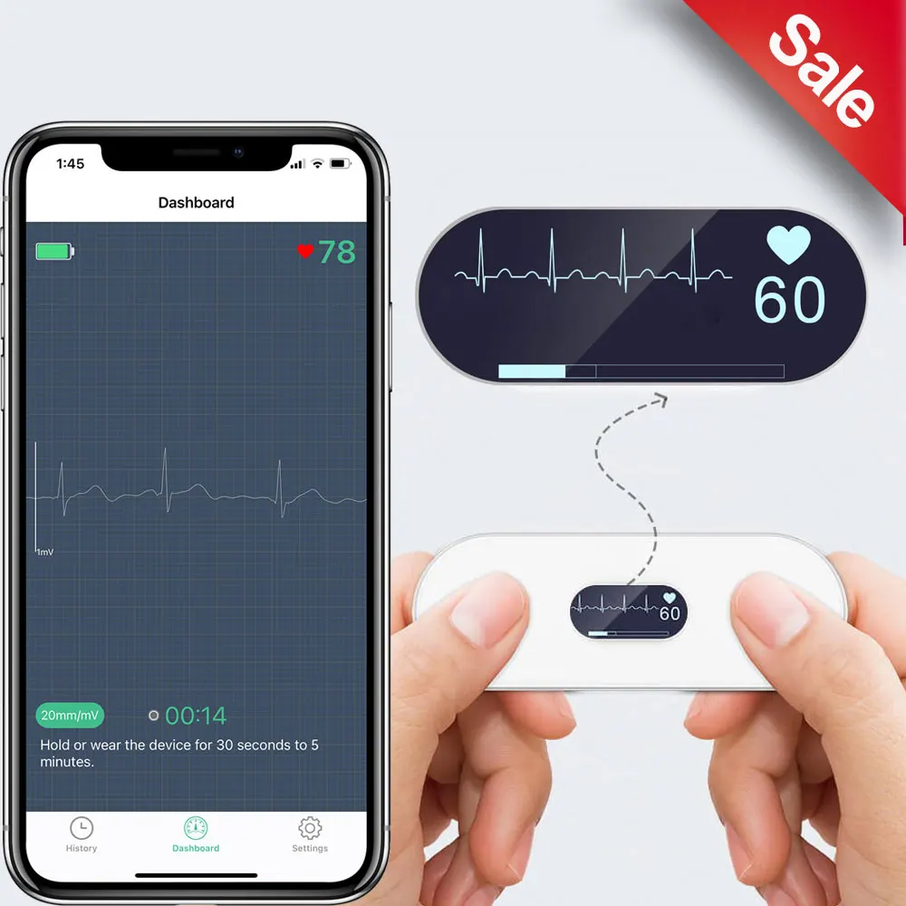 

Монитор ЭКГ Holter с OLED-экраном и функцией Bluetooth