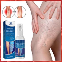 varicose vein spray treatment phlebitis vasculitis relieve leg pain blood vessel massage care spray 30ml fast and free shipping