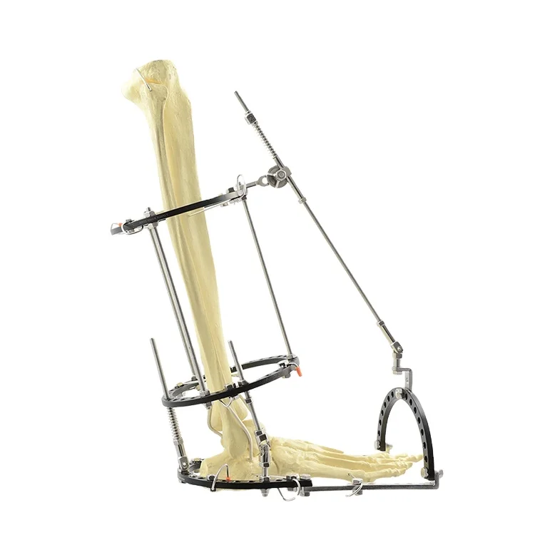 

CAREFIX CareFix Trauma Product For Foot Orthopedic Surgical Instruments