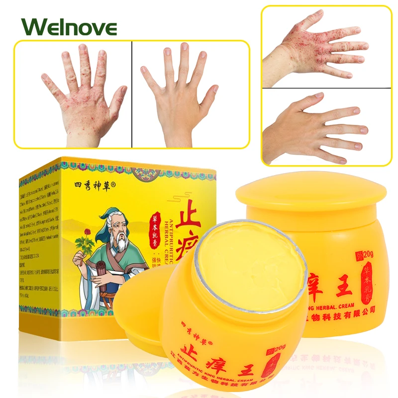 

20G Anti-Itch Hard Ointment Fast Antibacterial Dermatitis Pruritus Eczema Psoriasis Cream Herbal Chinese Medical Cream Skin Care