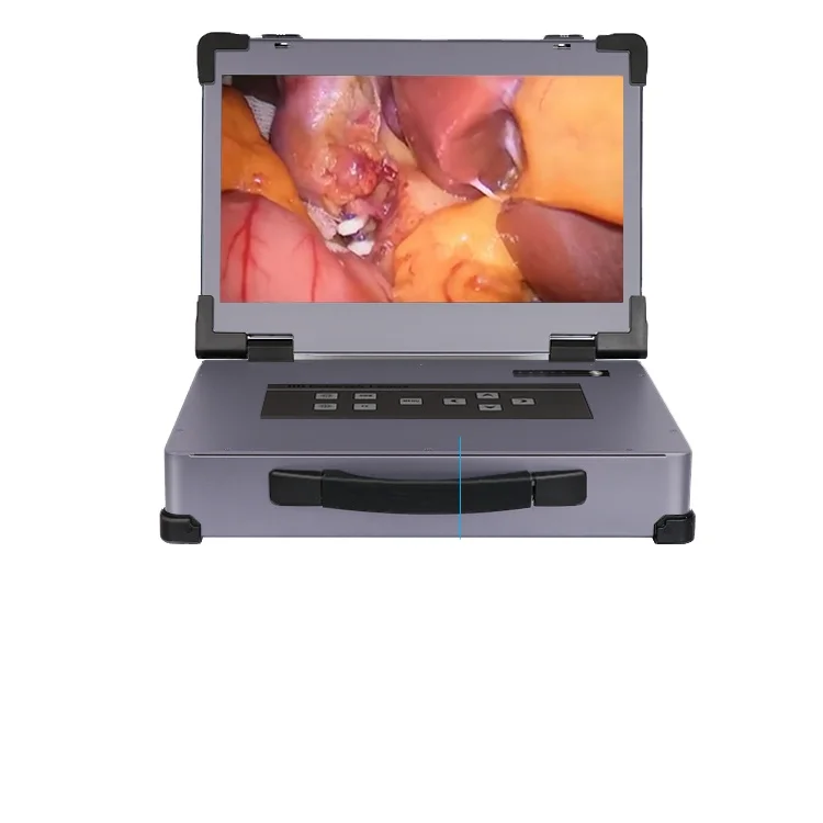 Эндоскопические камеры для ладоскопа Full HD/оборудование эндоскопии