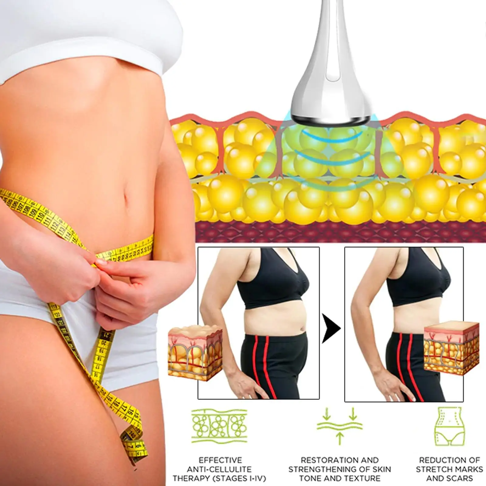 Антифриз 70 г мембрана для замораживания жира аппарат похудения Липо