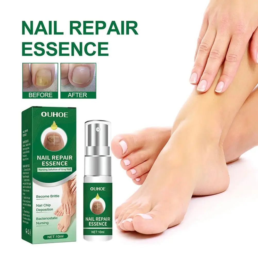 

Toenail Repair Essence Nail Treatment & Strengthener Renews Nails Healthy Nail Formula Strengthening Extra Stong Repair Solution