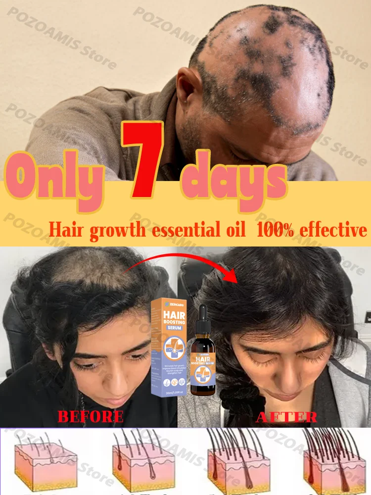 Имбирное масло для волос натуральная эссенция уход против выпадения увлажняющий