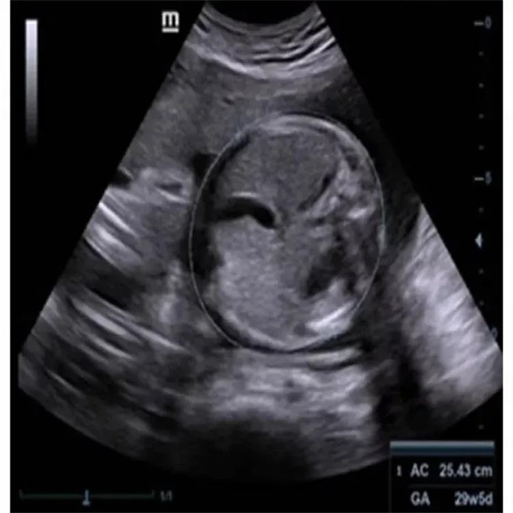 Медицинское ультразвуковое устройство Mindray портативный цветной допплер