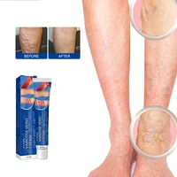 varicose veins relief cream vasculitis phlebitis spider pain relief ointment medical plaster body care 20g