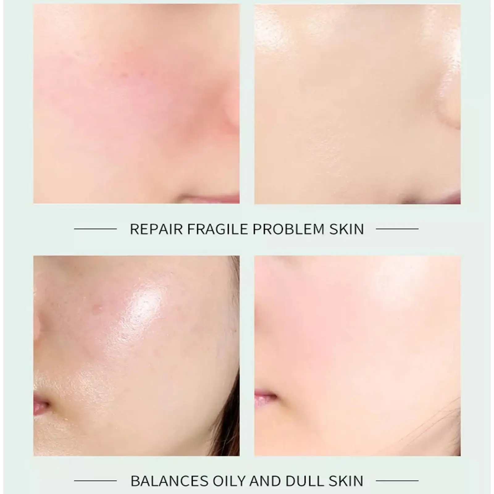 Крем для лица салициловой кислотой сужения пор