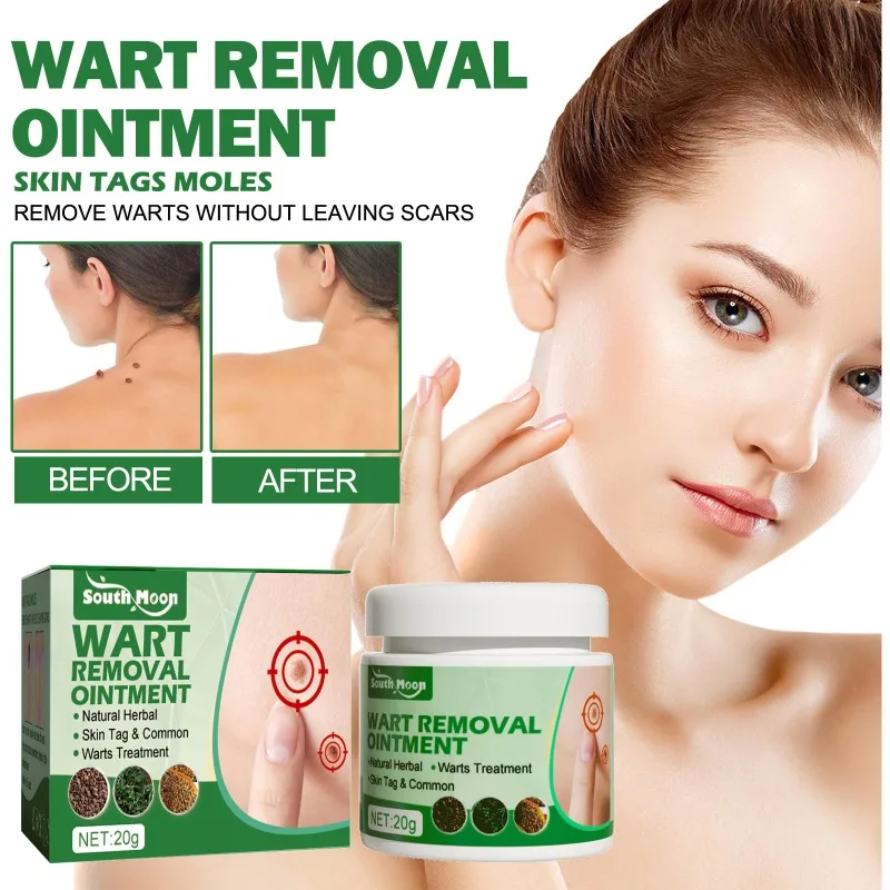 

Wart Treatment Cream flat Warts Removal Antibacterial Ointment Remove Skin Tag Hand Foot Corn Mole Acne Herbal Medical Plaster