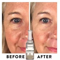 strong anti wrinkle serum ha ageing collagen anti aging remover eye bag dark circle face cream serum filler whitening cream
