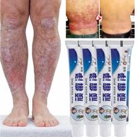 against psoriasis cream natural herbal antifungal treatment antipruritic calming repairing dermatitis ointment body skin care