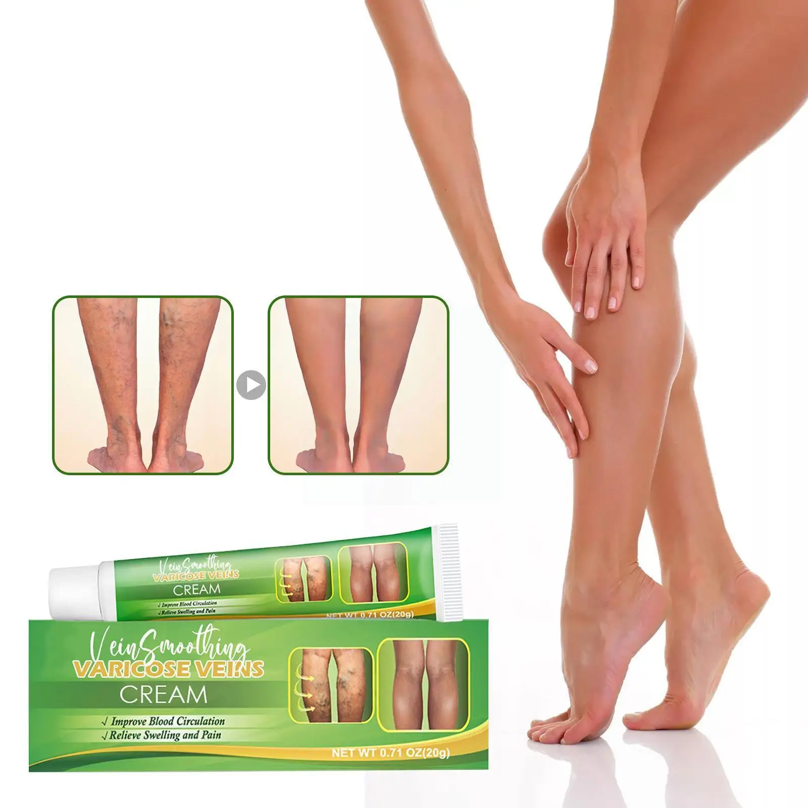 

Varicose Veins Treatment Cream Relieve Tired Legs Dilated Spider Pain Vein Ointment Phlebitis Smoothing Cream Relief Vascul R9C1