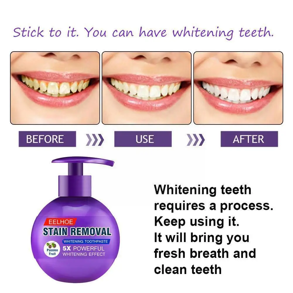 

250g Whitening And Stain Removing Baking Soda Toothpaste, Fights Gum Blueberry, Passion Fruit Bleeding W9f4