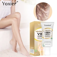varicose vein cream improve vasculitis phlebitis spider legs pain relief varicose vein treatment promote blood circulation 50g